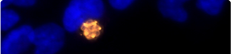 banniere-recherche-toxoplasma